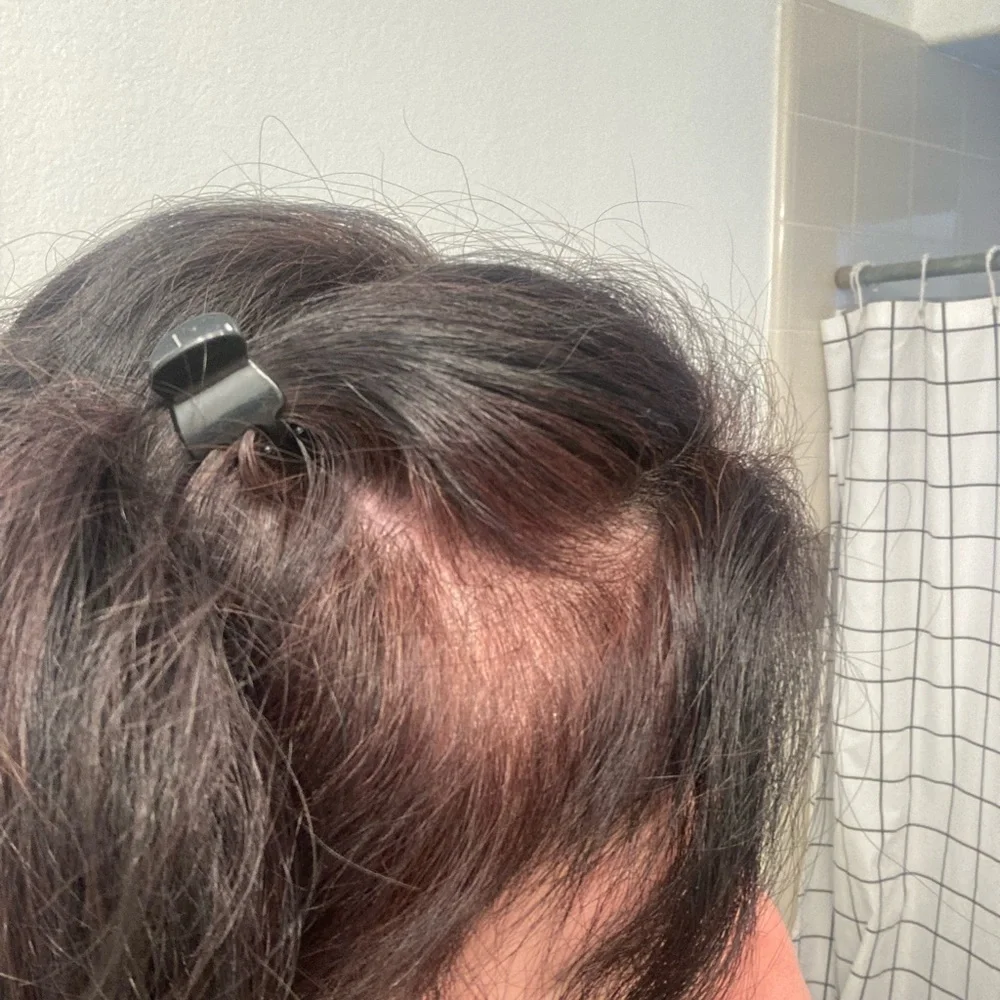 Arzola’s‎ shampoo for hair growth
